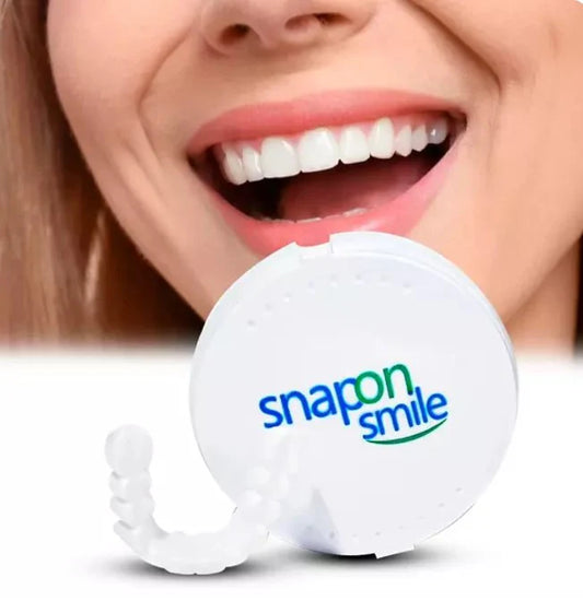 Carillas dentales