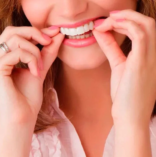 Carillas dentales